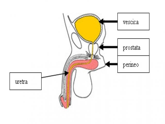 cosa causa la riduzione del pene ingrandimento del pene con smagliature